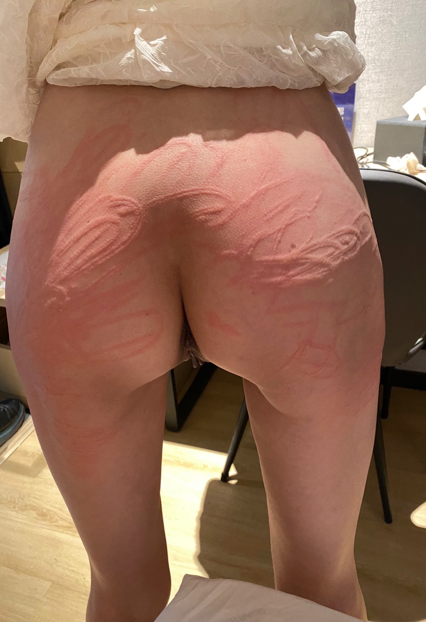 今天的主題是屁股