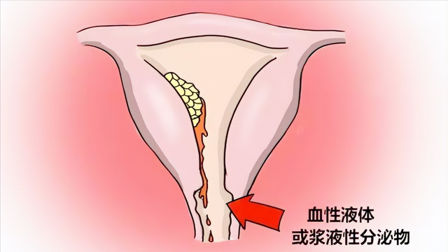 為什么女性下方會有異味？哪些異味要引起注意？醫生幫您分析