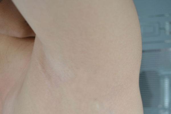 為何有的女人腋毛很長，有的卻沒有？腋毛真能刮嗎？一次性說明白