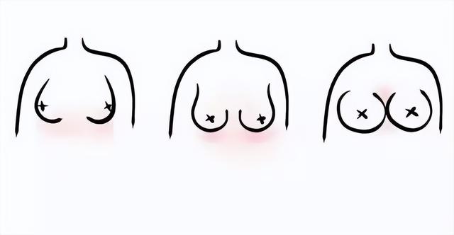 原來女生的胸部形狀有那么多種？東亞女性胸部偏小真是基因所致？