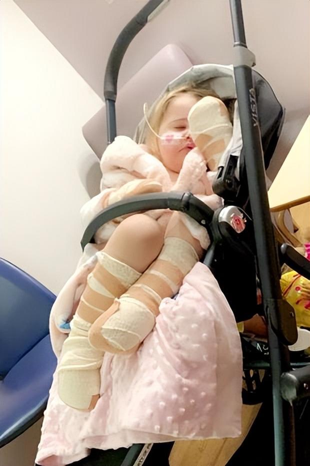 6歲女孩芭蕾舞看哭眾人:因患白血病和敗血癥,她的手腿均被截斷