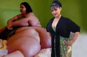 世界最胖的女人(梅拉：世界第一胖，被妹妹陷害遭丈夫拋棄，后狂減800斤實現蛻變)