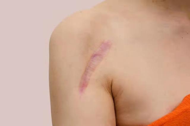 2019年，一位重男輕女的山東父親家暴10多年，中考前殺害15歲女兒
