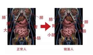 女人左眼跳是好兆頭嗎(南寧一女子五臟六腑全部反著長，醫生：罕見的先天性畸形，發病率約為百萬分之一)