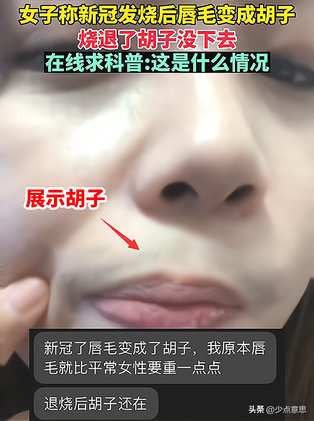 ?江蘇:女子陽后長(zhǎng)出來胡子,被懷疑是特效,“我這怎么出門啊”