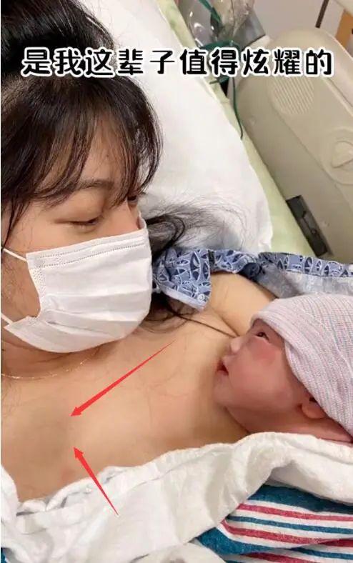 女星開(kāi)奶胸前被揉致淤青:其實(shí)你完全不該受這個(gè)罪