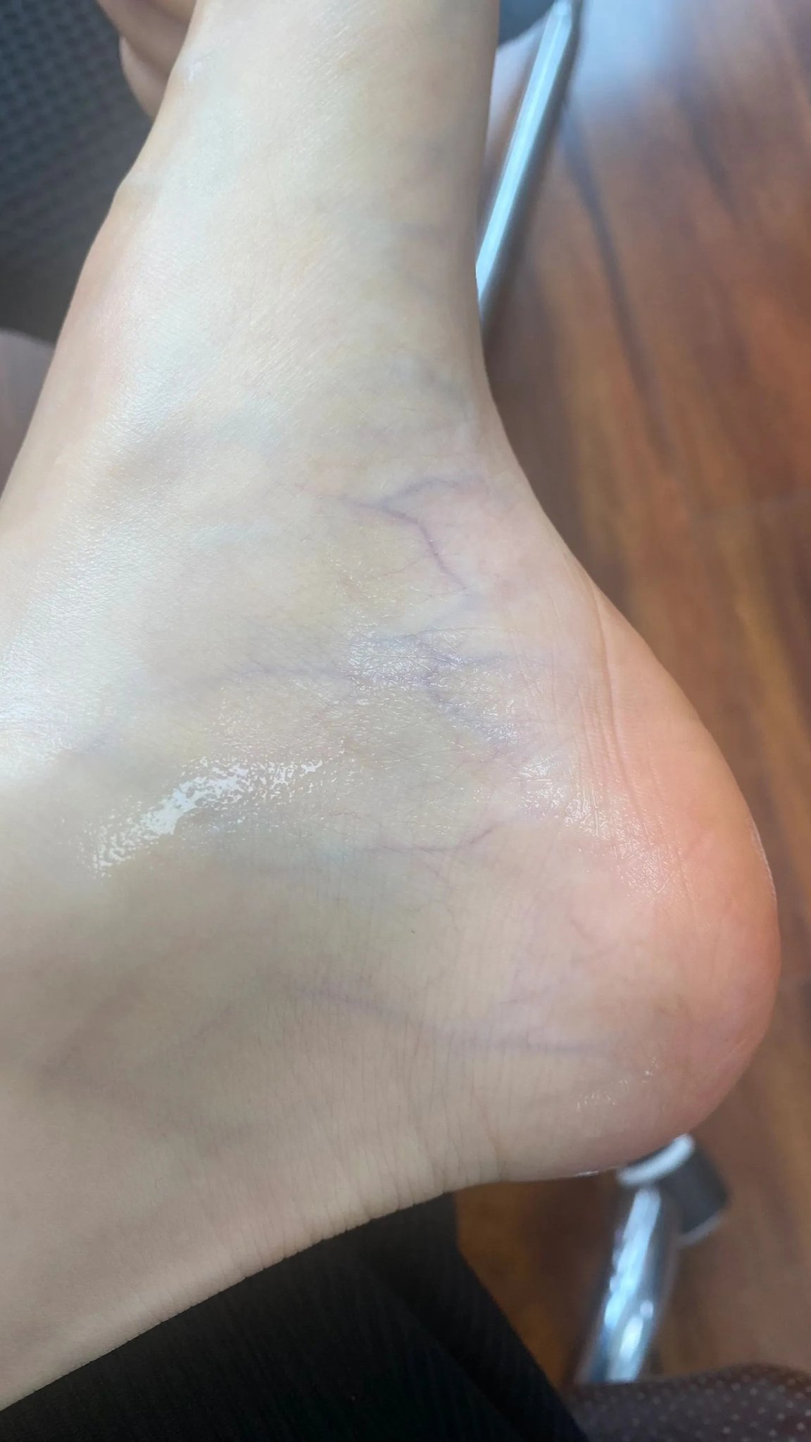各種腳，包括黃圣依的