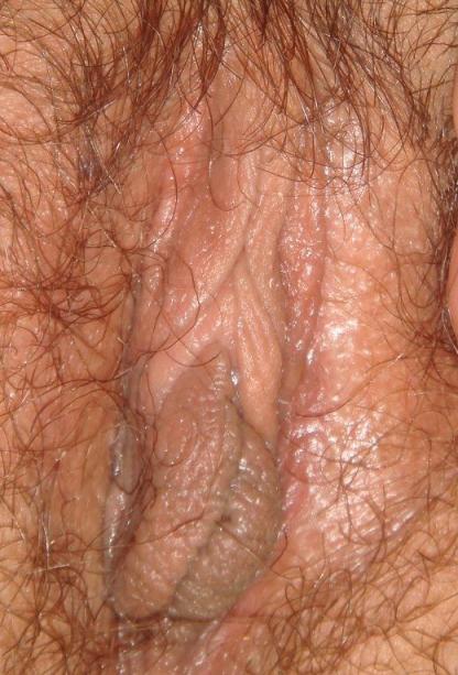大姨